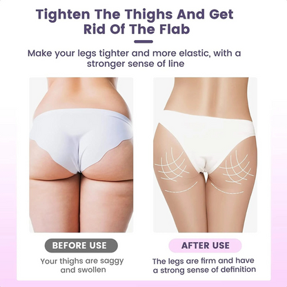 StreeFit™ Pelvic & Thigh Muscle Trainer